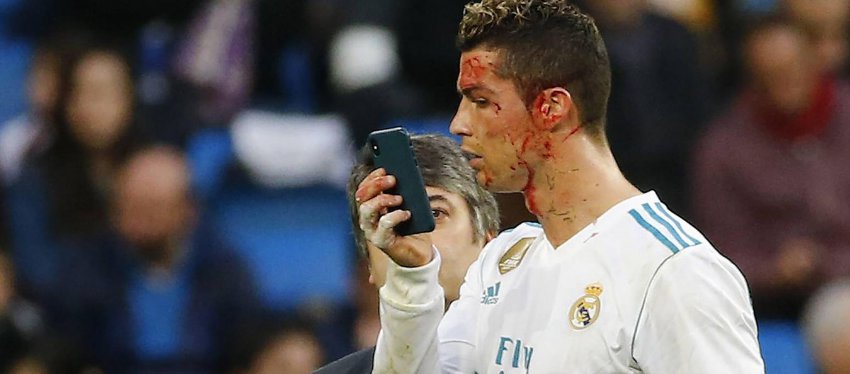 Cristiano, en un accidentado partido con el Real Madrid. Foto: Eurosport.